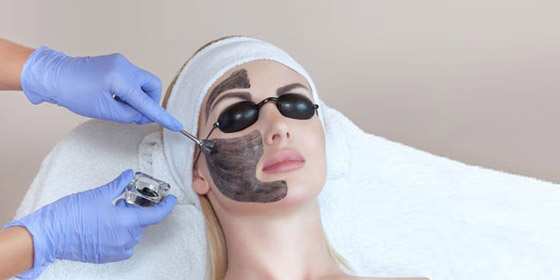 «الليزر الكربوني».. صيحة تجميلية تعزز جمال بشرتكِ صورة رقم 3