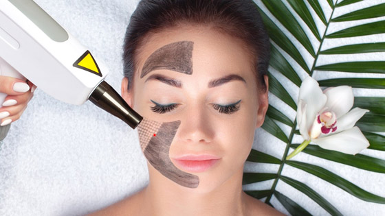 «الليزر الكربوني».. صيحة تجميلية تعزز جمال بشرتكِ صورة رقم 4