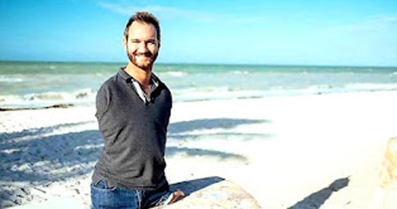 أغرب 10 أشخاص في العالم، لا تصدق أنهم يعيشون معنا. صورة رقم 3 أغرب 10 أشخاص في العالم، لا تصدق أنهم يعيشون معنا. صورة رقم 3