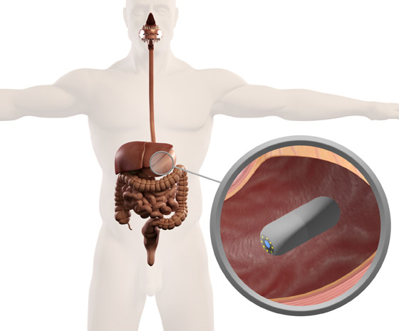 ثورة طبية بنتائج دقيقة.. نجاح تجارب ثورة طبية بنتائج دقيقة.. نجاح تجارب