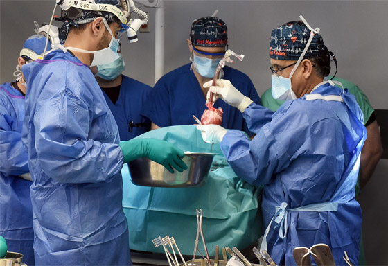 بعد 6 أسابيع من العملية.. وفاة ثاني مريض يُزرع له قلب خنزير معدل وراثيا صورة رقم 6 بعد 6 أسابيع من العملية.. وفاة ثاني مريض يُزرع له قلب خنزير معدل وراثيا صورة رقم 6