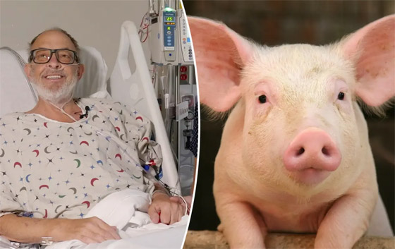 بعد 6 أسابيع من العملية.. وفاة ثاني مريض يُزرع له قلب خنزير معدل وراثيا صورة رقم 8 بعد 6 أسابيع من العملية.. وفاة ثاني مريض يُزرع له قلب خنزير معدل وراثيا صورة رقم 8