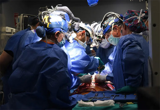 بعد 6 أسابيع من العملية.. وفاة ثاني مريض يُزرع له قلب خنزير معدل وراثيا صورة رقم 9 بعد 6 أسابيع من العملية.. وفاة ثاني مريض يُزرع له قلب خنزير معدل وراثيا صورة رقم 9