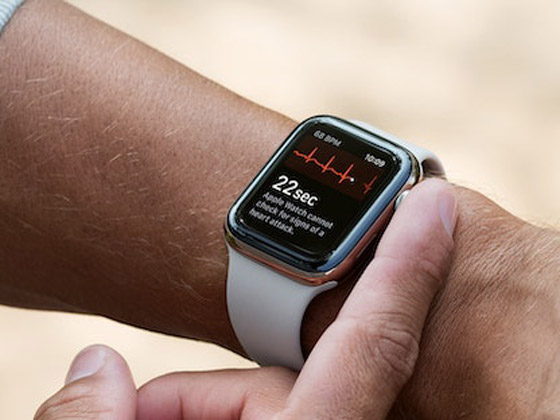 5 ميزات لساعة آبل يمكن أن تفيد مرضى السكري صورة رقم 3