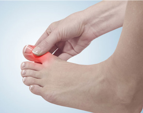 5 عناصر غذائية تتحكم في مستويات حمض البوليك صورة رقم 2