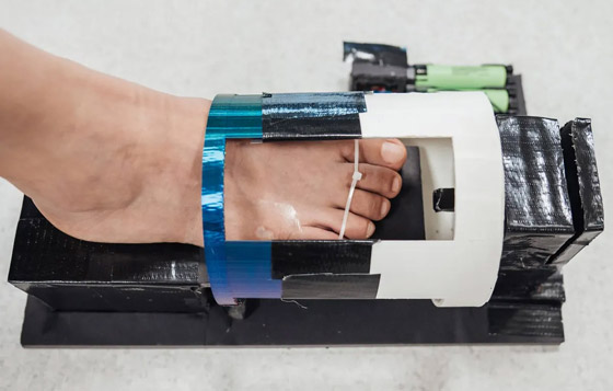 ابتكار طريقة للمساعدة على التئام جروح مرضى السكري بسرعة.. صور صورة رقم 1