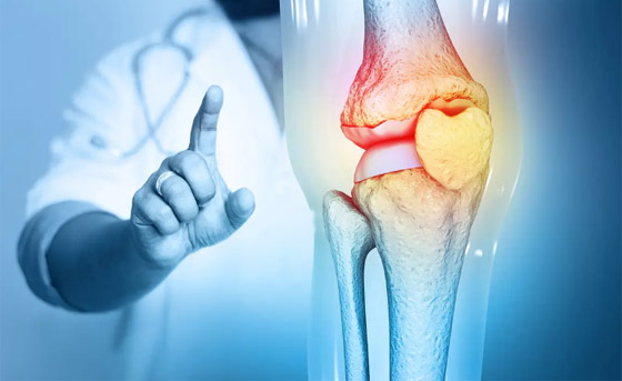 6 فوائد صحية مبهرة للكزبرة... احرص على إضافتها لوجباتك! صورة رقم 4