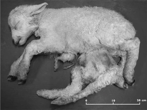 فيديو وصور: 6 من أغرب أنواع التوائم وأندرها في العالم صورة رقم 3