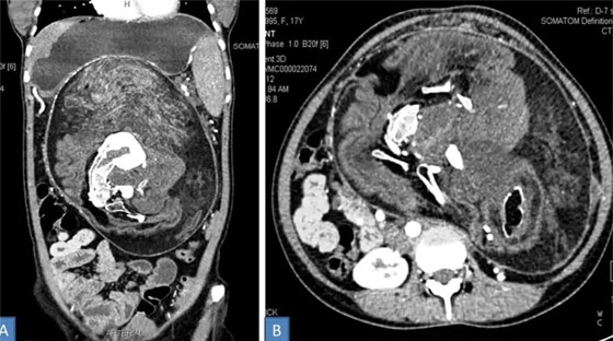 فيديو وصور: 6 من أغرب أنواع التوائم وأندرها في العالم صورة رقم 4