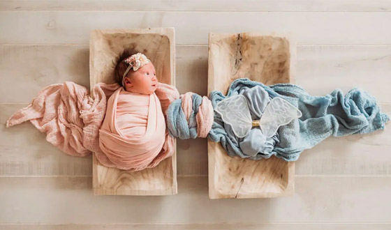 فيديو وصور: 6 من أغرب أنواع التوائم وأندرها في العالم صورة رقم 5