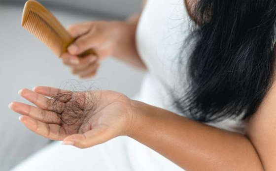 6 علامات تشير إلى وجود أمراض خطيرة وراء تساقط الشعر صورة رقم 8