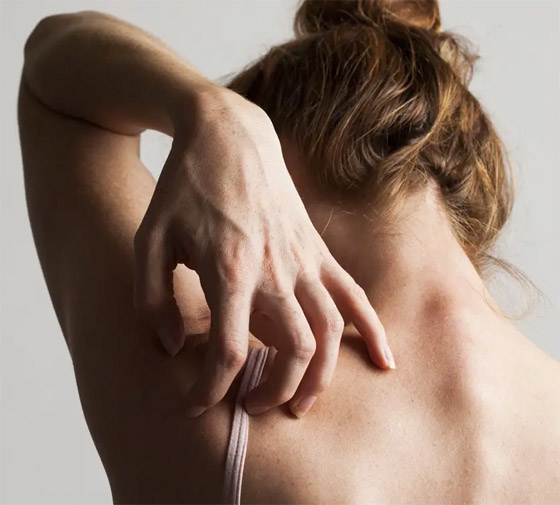 6 علامات تشير إلى وجود أمراض خطيرة وراء تساقط الشعر صورة رقم 7