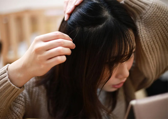 لشعر كثيف بصحة جيدة ومظهر رائع.. إليك طريقة طبيعية مُجربة صورة رقم 2