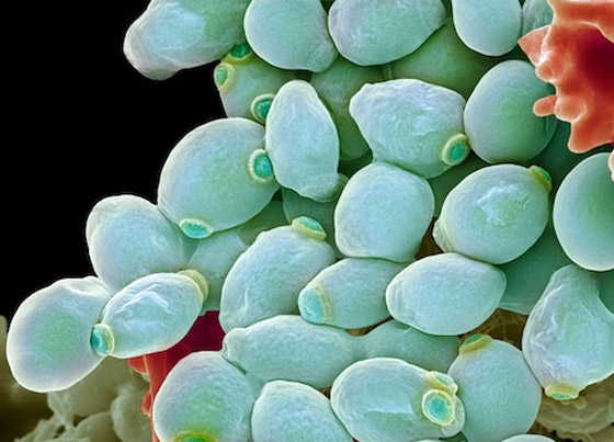 بعد وفاة جندي إسرائيلي بنوع مجهول منها التقطه في قطاع غزة.. أخطر 10 فطريات فتاكة مسببة للعدوى والموت صورة رقم 3