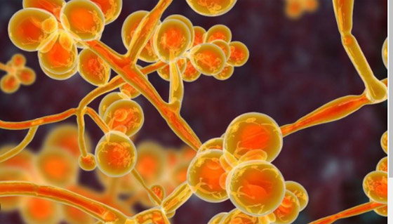 بعد وفاة جندي إسرائيلي بنوع مجهول منها التقطه في قطاع غزة.. أخطر 10 فطريات فتاكة مسببة للعدوى والموت صورة رقم 7