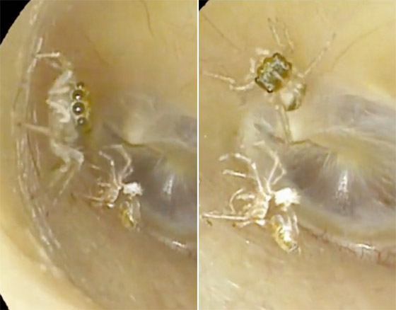 لسان بشعر وجنين داخل دماغ طفل.. أغرب الحالات الطبية في 2023 صورة رقم 6