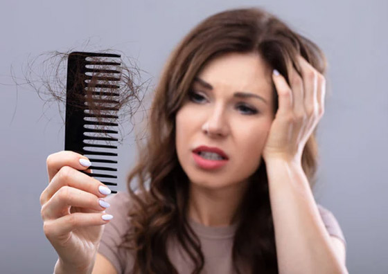 6 فيتامينات نقصها بالجسم يرتبط بتساقط الشعر صورة رقم 9