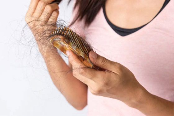 6 فيتامينات نقصها بالجسم يرتبط بتساقط الشعر صورة رقم 7