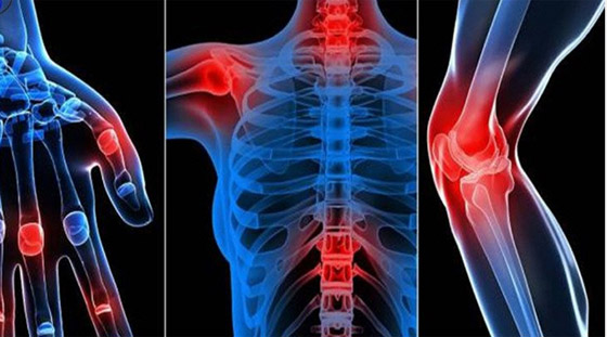 لهذه الأسباب تزداد آلام العظام والمفاصل في الشتاء.. وهذا هو الحل صورة رقم 5