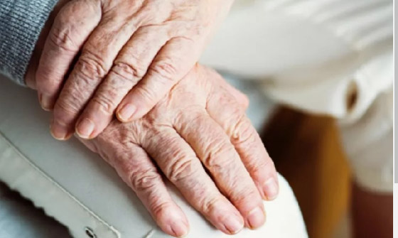 عادات تسرع شيخوخة اليدين.. تجنبيها! صورة رقم 4