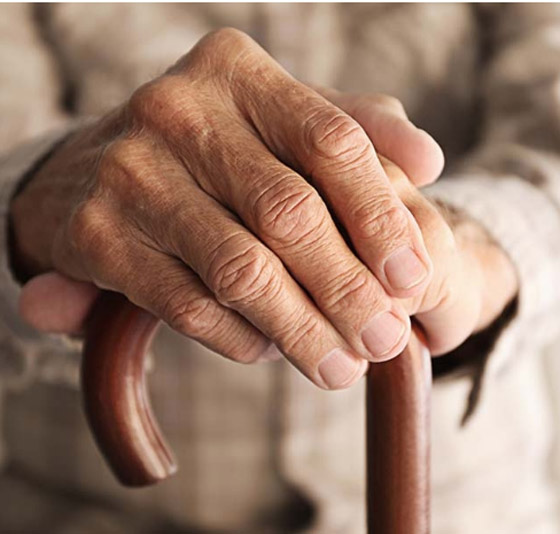 عادات تسرع شيخوخة اليدين.. تجنبيها! صورة رقم 6