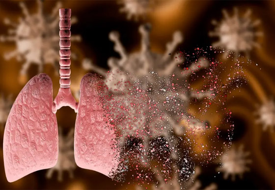 عكس المتوقع.. التمارين الرياضية تؤدي إلى تفاقم هذا المرض! صورة رقم 3