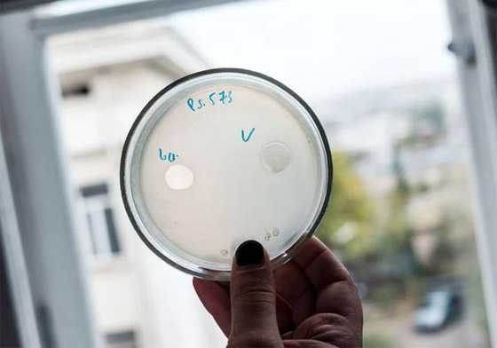 البكتيريا الخارقة.. مرض يهدد بقتل الملايين سنويا بحلول 2050 صورة رقم 3