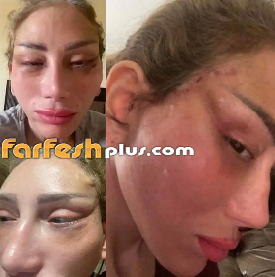 توقيف ريهام سعيد بمطار بيروت، وتتهم دكتور تجميل باستخدام نفوذه بعد تشويه وجهها! صورة رقم 5