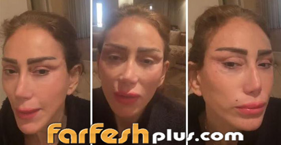 توقيف ريهام سعيد بمطار بيروت، وتتهم دكتور تجميل باستخدام نفوذه بعد تشويه وجهها! صورة رقم 3