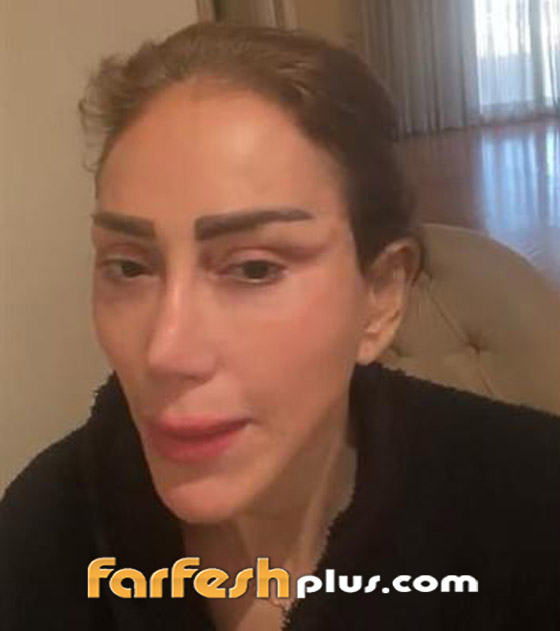 توقيف ريهام سعيد بمطار بيروت، وتتهم دكتور تجميل باستخدام نفوذه بعد تشويه وجهها! صورة رقم 7