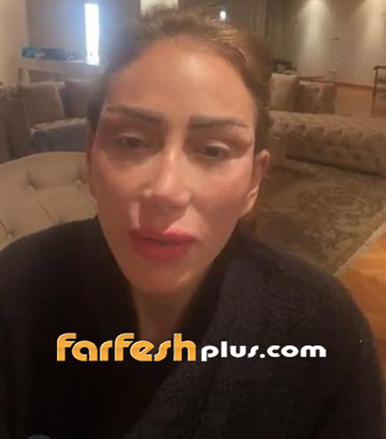 الإعلامية المصرية ريهام سعيد تزعم انتصارها على نادر صعب ودكتور التجميل اللبناني الشهير يُكذبها! صورة رقم 9