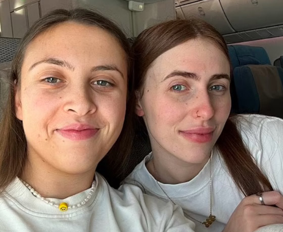 امرأة تصاب بجلطة بساقها بسبب نومها في رحلة طيران! صورة رقم 2