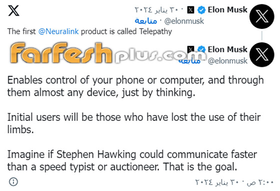 الملياردير إيلون ماسك يعلن عن نجاح زرع شريحة دماغية بأول إنسان صورة رقم 3