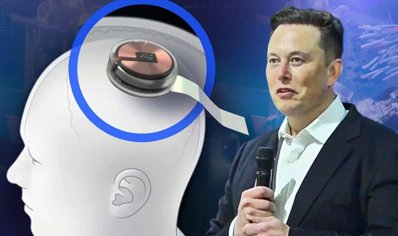 الملياردير إيلون ماسك يعلن عن نجاح زرع شريحة دماغية بأول إنسان صورة رقم 7