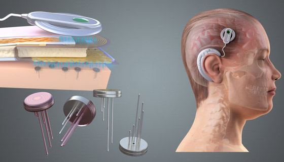 الملياردير إيلون ماسك يعلن عن نجاح زرع شريحة دماغية بأول إنسان صورة رقم 9