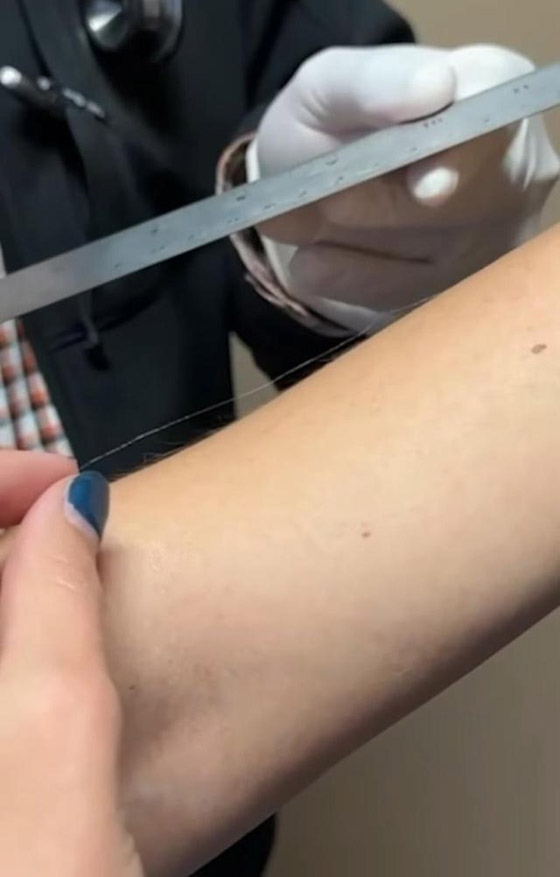 فيديو: أمريكية تحطم رقما قياسيا عالميا لأطول شعر على ذراعيها صورة رقم 4