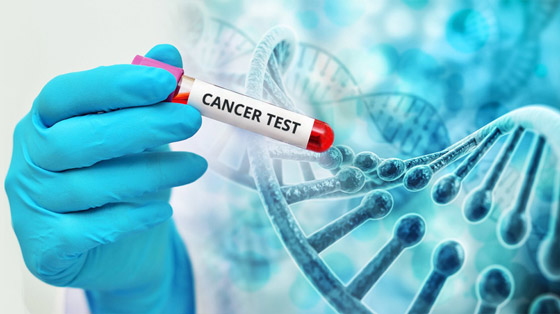 الطريقة المعتمدة في تصنيف السرطانات باتت قديمة.. ما السبب؟ صورة رقم 5