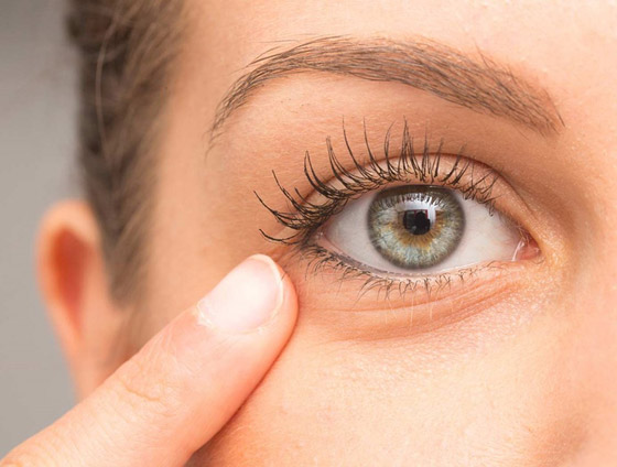 للتخلص من التجاعيد تحت العينين.. اتبعي هذه النصائح صورة رقم 5