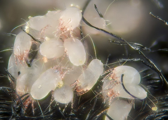 احذروا عثّ الغبار: مخلوقات صغيرة في سريرنا! صورة رقم 2