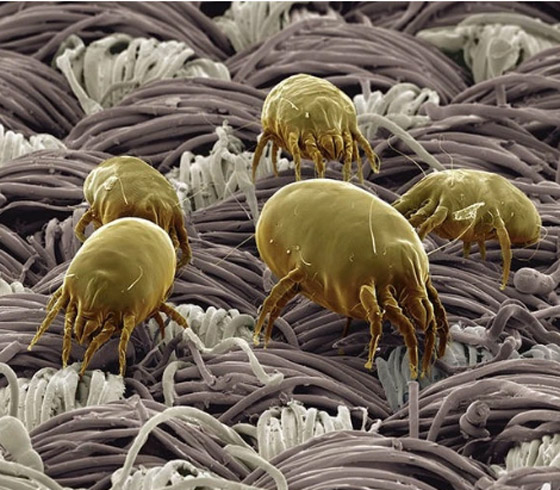 احذروا عثّ الغبار: مخلوقات صغيرة في سريرنا! صورة رقم 5