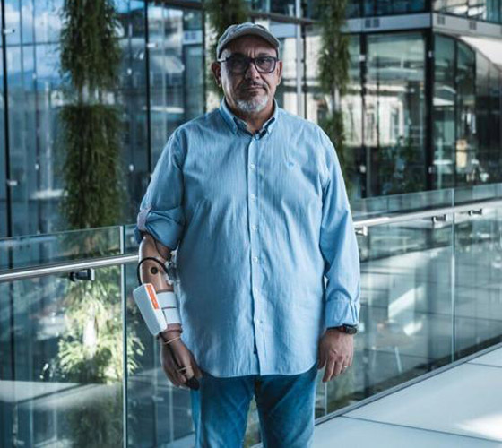 فيديو: تطوير أول طرف صناعي قادر على استشعار درجات الحرارة صورة رقم 2