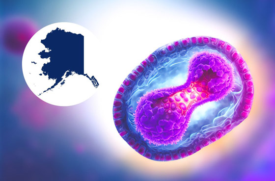 فيروس جديد يقتل أول مصاب به.. ماذا نعرف عن (جدري آلاسكا) ونصائح السلطات الصحية لتجنبه صورة رقم 2 فيروس جديد يقتل أول مصاب به.. ماذا نعرف عن (جدري آلاسكا) ونصائح السلطات الصحية لتجنبه صورة رقم 2