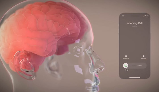 جديد شريحة ماسك المزروعة بالدماغ.. المريض حرك فأرة بمجرد التفكير صورة رقم 2