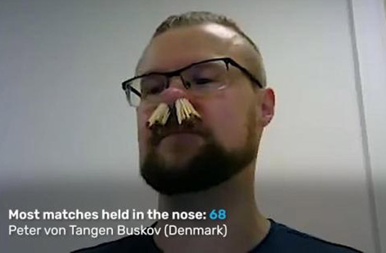 بإدخال 68 عود ثقاب في أنفه.. رجل دنماركي يدخل موسوعة غينيس صورة رقم 4