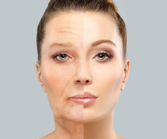 9 أطعمة تسرع من شيخوخة البشرة.. تجنبوها..! صورة رقم 1