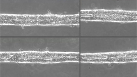لأول مرة.. تطوير نموذج مصغر ثلاثي الأبعاد للجهاز العصبي البشري (فيديو) صورة رقم 1