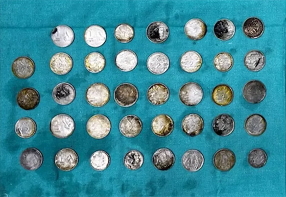 شاب يبتلع 37 مغناطيس و39 عملة معدنية ليبني عضلات! صور صورة رقم 4