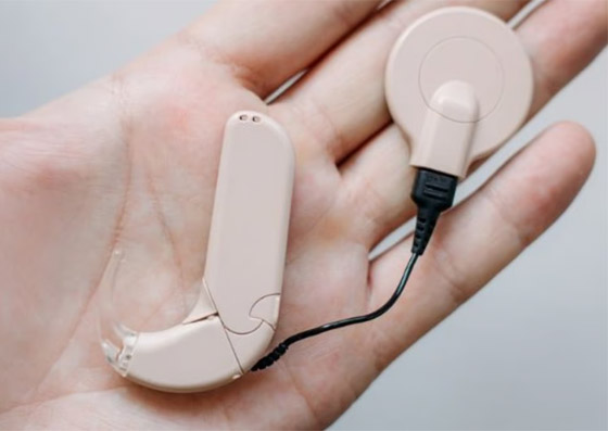 فيديو مؤثر: لحظة سماع طفل سعودي لأول مرة في حياته صورة رقم 9 فيديو مؤثر: لحظة سماع طفل سعودي لأول مرة في حياته صورة رقم 9