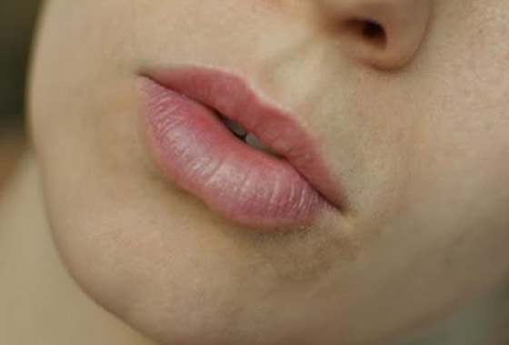 علاج البقع الداكنة حول الفم بوصفات طبيعية 100% صورة رقم 1