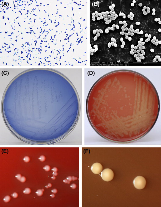 عدوى بكتيرية نادرة تتفشى باليابان.. والسلطات تكافح لتحديد سبب الانتشار صورة رقم 6 عدوى بكتيرية نادرة تتفشى باليابان.. والسلطات تكافح لتحديد سبب الانتشار صورة رقم 6